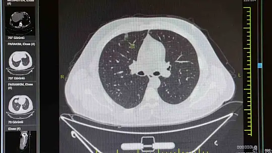 Doktor öğretim üyesi Azar: 'Elektronik sigara tütün mamullerini bırakmak için çıktı fakat kendisi yıllar içerisinde bağımlılık oluşturdu'