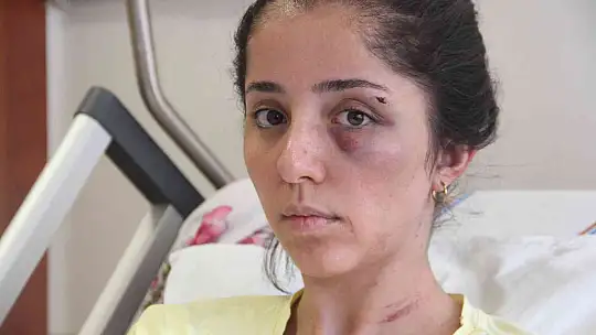 Doktor sevgilisinin evinde dehşeti yaşayan genç kadın 2 saat boyunca darp edildi, 5 yerinden bıçaklandı
