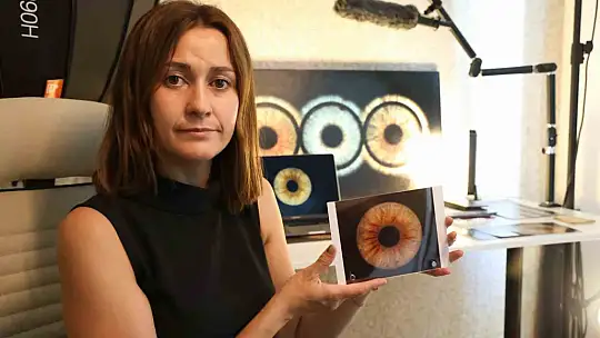 Elazığ'da 'gözler' sanata dönüşüyor