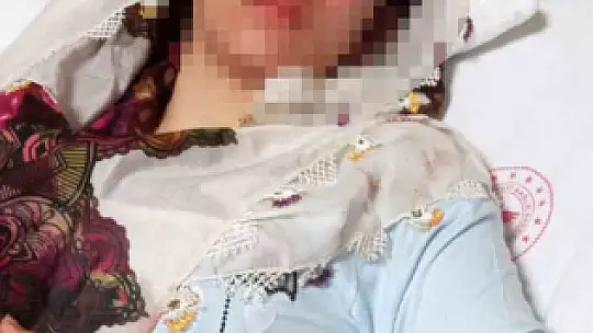 Elazığ'da kayıp kuzenler olayında iddialara yalanlama: 'Beni görünce 2. kattan atladı, yumrukla kendini bu hale getirdi'