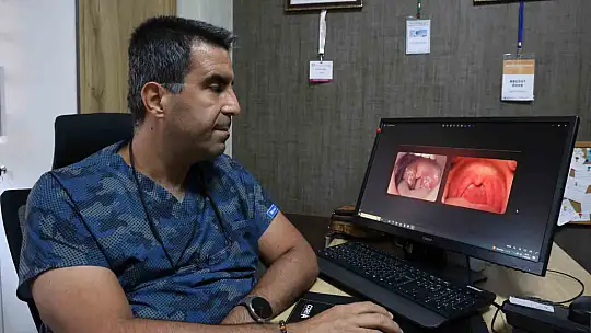 KBB Uzmanı Op. Dr. Özer: ''Kronik farenjit, özellikle yaz aylarında problem oluşturuyor''
