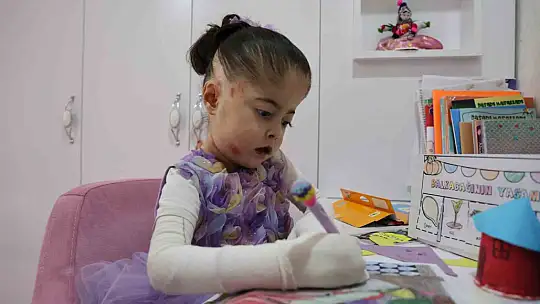 Kelebek hastası çocuğu kendi çocuğundan ayırt etmedi, yaptıklarıyla gönülleri fethetti
