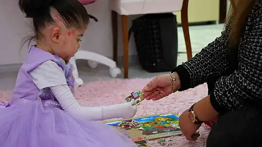 Kelebek hastası çocuğu kendi çocuğundan ayırt etmedi, yaptıklarıyla gönülleri fethetti