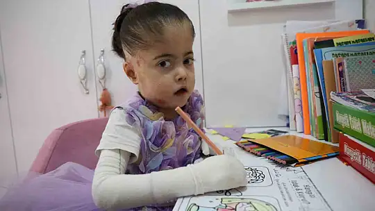 Kelebek hastası çocuğu kendi çocuğundan ayırt etmedi, yaptıklarıyla gönülleri fethetti
