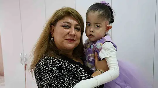 Kelebek hastası çocuğu kendi çocuğundan ayırt etmedi, yaptıklarıyla gönülleri fethetti