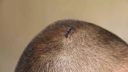 Tıraş makinesi yere düştü, bir ailenin huzuru yok oldu